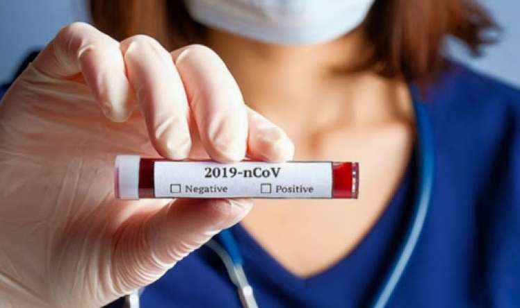 Gürcüstanda 1 872 nəfərdə koronavirus aşkarlandı  