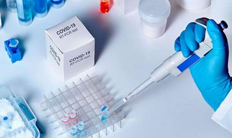 Rusiya MDB ölkələrinə koronavirus testləri tədarük etdi  