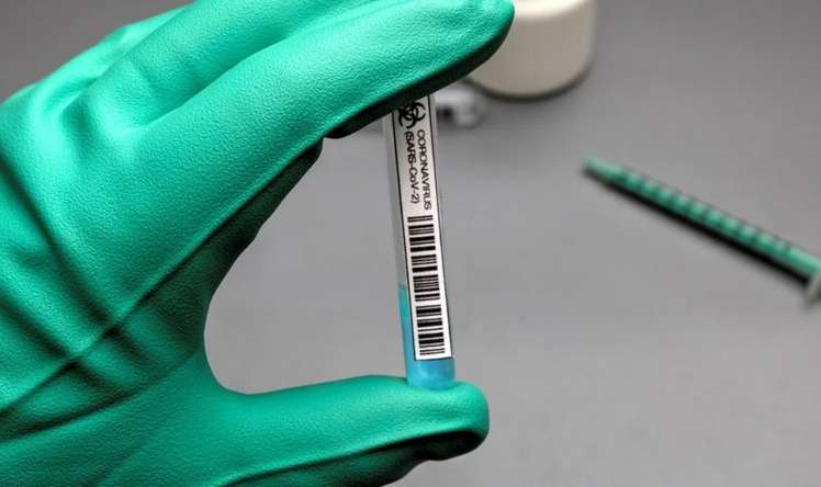 Dünyada koronavirusa rekord yoluxma qeydə alındı 