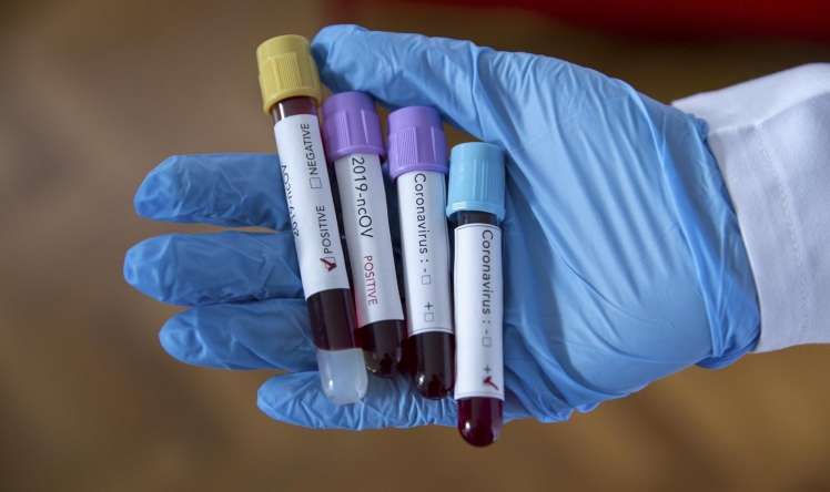 Rusiya millisində 13 koronavirus aşkarlandı 