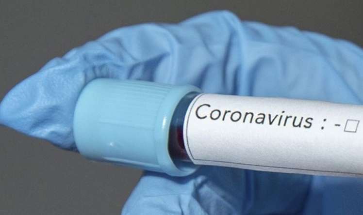 Ermənistanda 984 nəfərdə koronavirus aşkarlandı  
