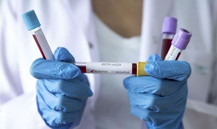  İranda ötən sutka 10827 nəfər koronavirusa yoluxdu  