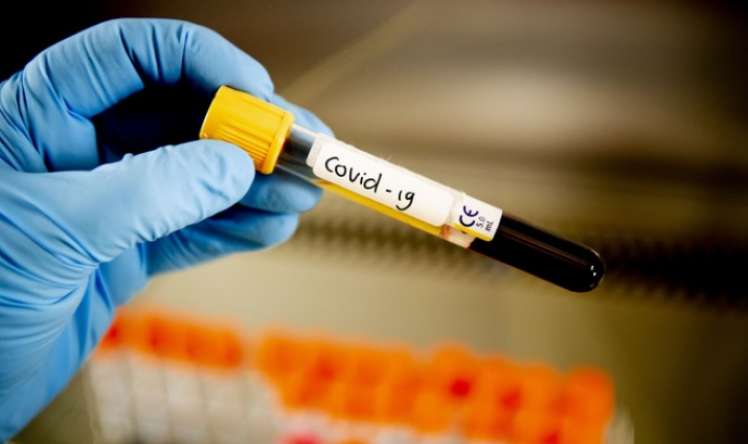 Moskvada son sutkada koronavirusdan 76 nəfər öldü 