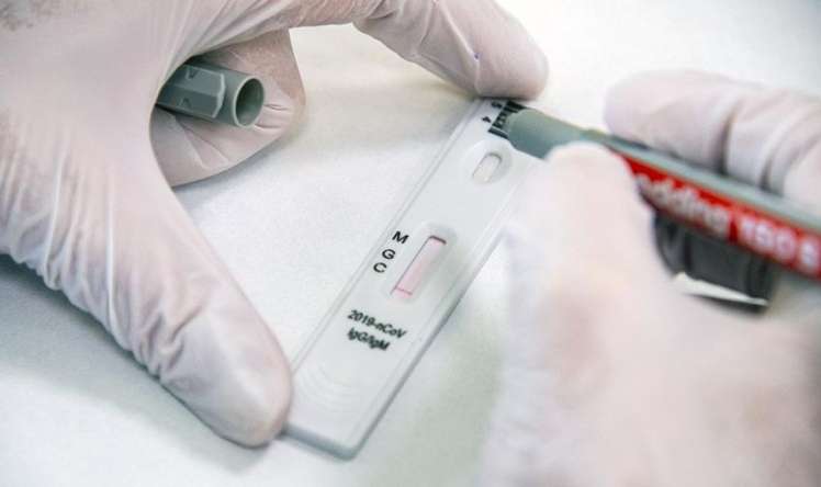 Koronavirusun antitel testi nə vaxt verilməlidir? 