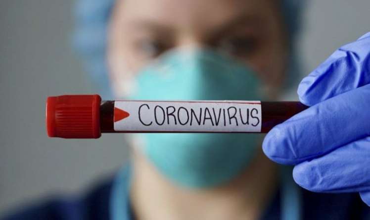 Ermənistanda 5 750 aktiv koronavirus xəstəsi var 