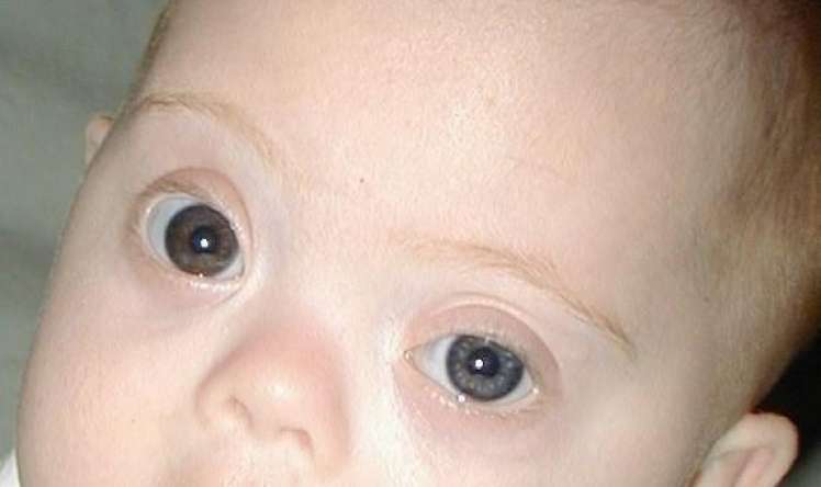 Глазки в 3 месяца. Разрез глаз у новорожденных. Глаза новорожденного ребенка. Разрез глаза у новорожденного.