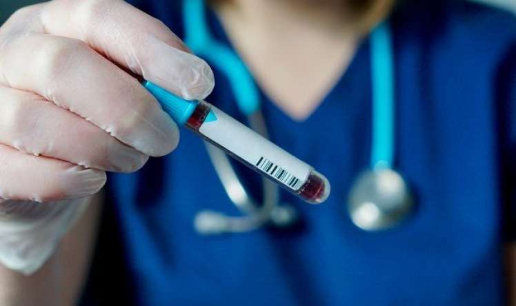 Yoluxanların bu günə olan statistikası:  9 nəfər öldü 