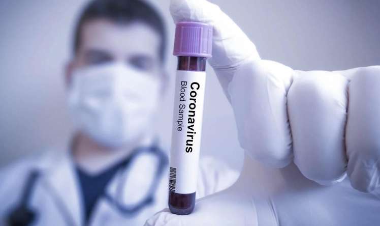 Azərbaycanda korona: 2237 yoluxma, 29 ölü -  Günün statistikası 