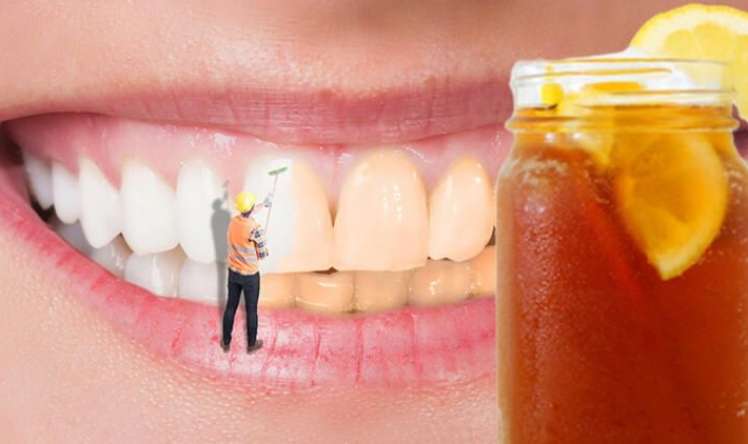 Dişlərinizin rəngini dəyişən  7 ÜSUL