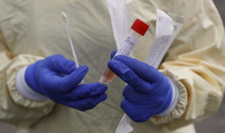 Türkiyədə bu gün 63 nəfər koronavirusun qurbanı oldu 