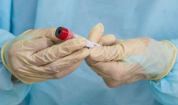 Dünyada koronavirusla bağlı son  VƏZİYYƏT
