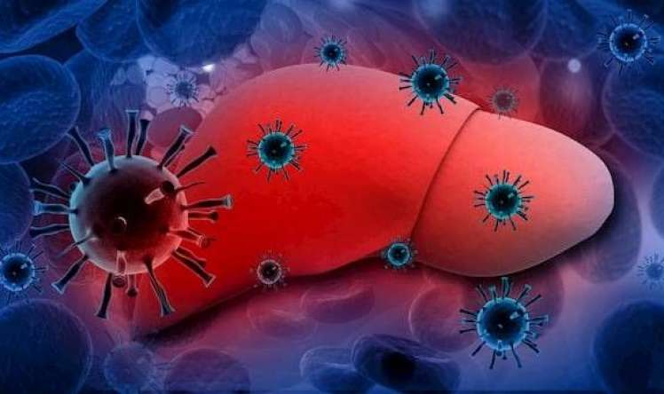 Hər il 1,4 milyon insan hepatitdən vəfat edir 