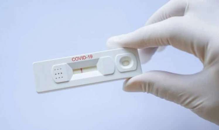 Apteklərdə satılan koronavirus testləri doğru göstərirmi? -  AÇIQLAMA - VİDEO