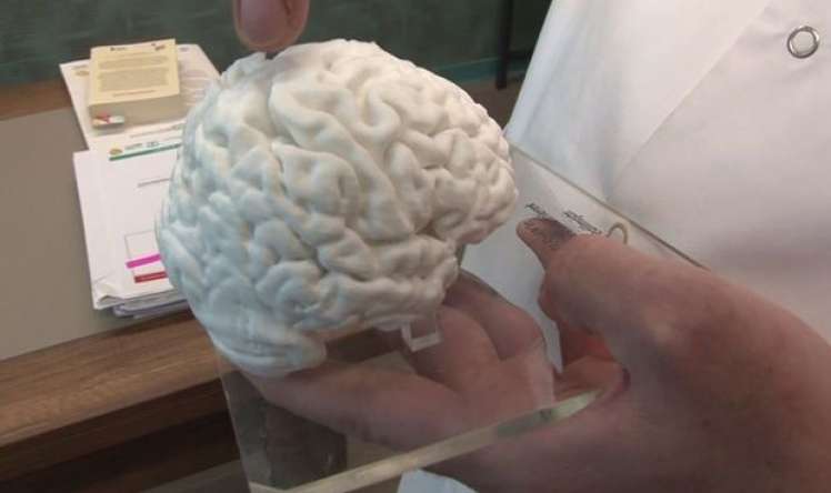Türkiyədə printerlə insan beyni hazırlandı 