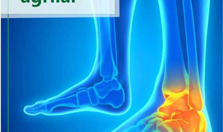 Ayaqlarda ağrıların 10 səbəbi 