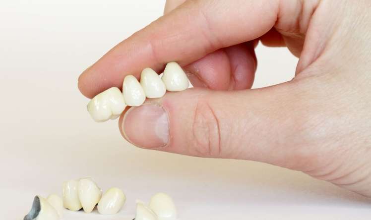 80% insanlar 40 yaşdan sonra dişlərini bu səbəbdən itirir   -  ALİMLƏR