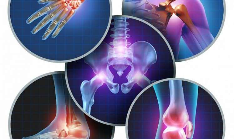 Böyük-kiçik oynaqlarda ağrı və yeyilmə səbəbi   - Osteoartrit nədir?