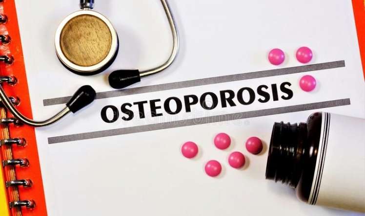 Osteoporoz- sümüklərin əriməsinə qarşı    lazım olan vitaminlər