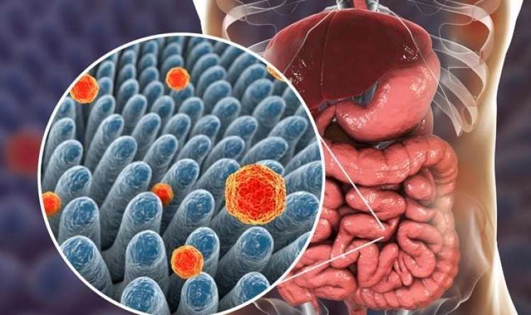Şəkərli diabetin səbəbi mikroblar ola bilər   -  Yeni kəşf