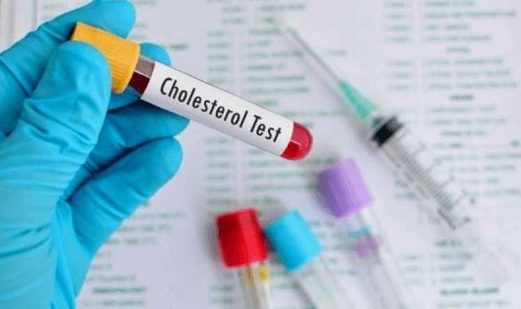 Xolesterin analizini ildə neçə dəfə vermək lazımdır? 