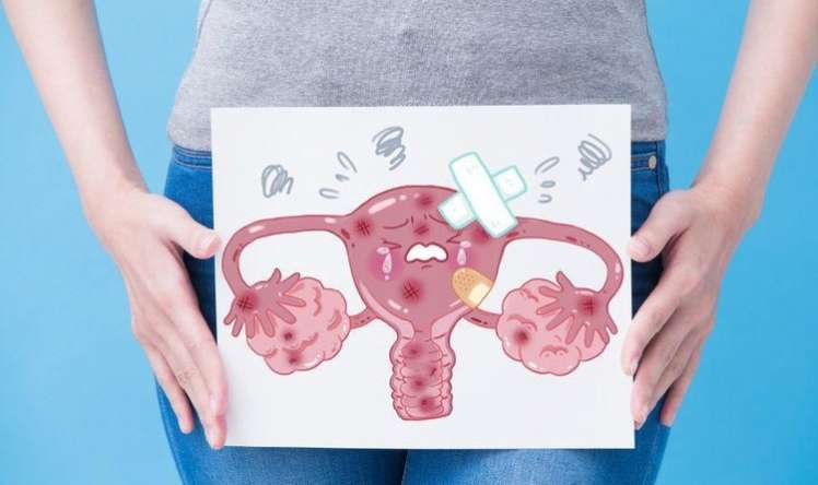 Endometrioz və menstrual ağrıların fərqi 