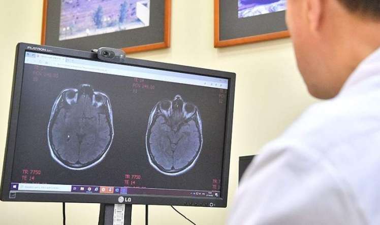 Dünyada ilk   - 19 yaşlı gəncdə demensiya aşkarlandı