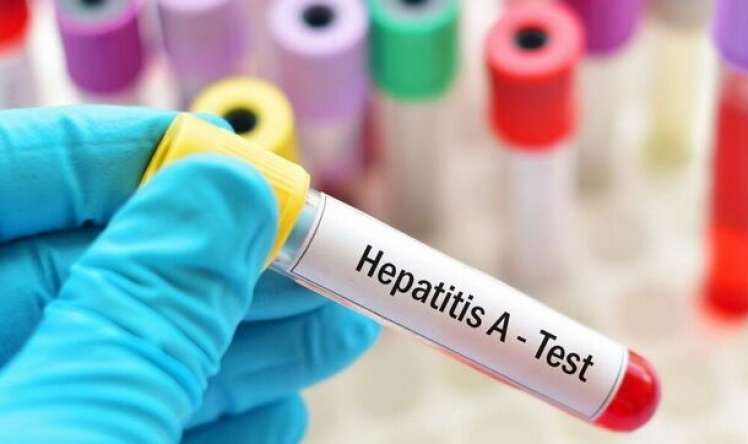 Səhyyə Nazirliyindən hepatitə yoluxan uşaqlarla bağlı  açıqlama
