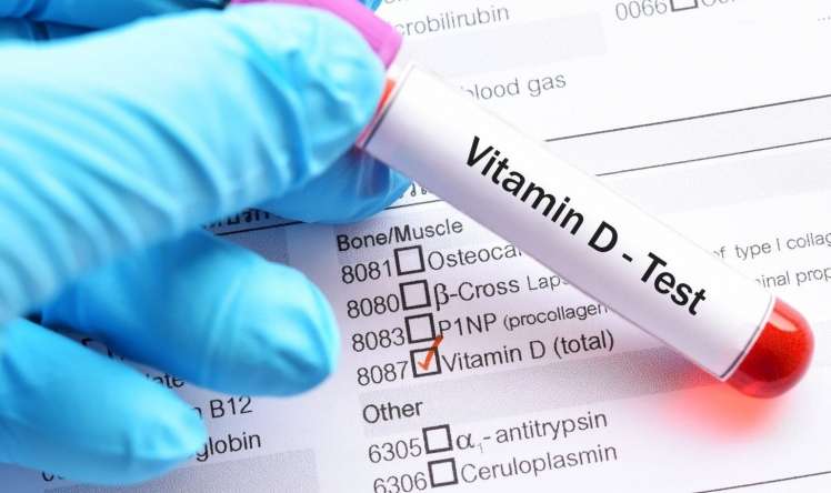 Vitamin D analizini vermək boşuna pul itkisidir  – Həkim