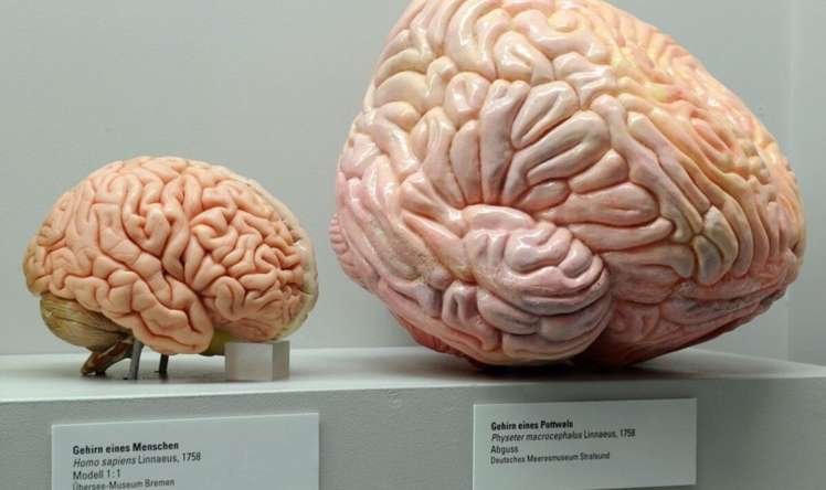 Beyini bədəndən ayrı canlı saxlamaq  mümkün olacaq