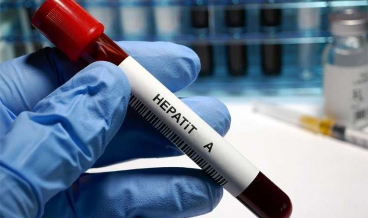Nazirlik Hepatit A infeksiyası  ilə bağlı məlumat yaydı