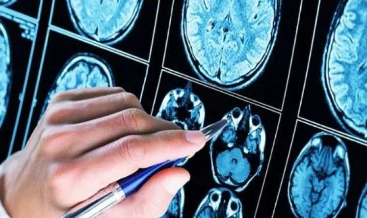 Kimlər erkən demensiya riski altındadır?  