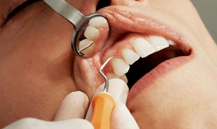 Diş çıxaran dərman satışa çıxarılır –  Tarix açıqlandı