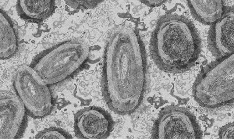 Daha bir epidemiya xəbərdarlığı:  3 nəfər öldü