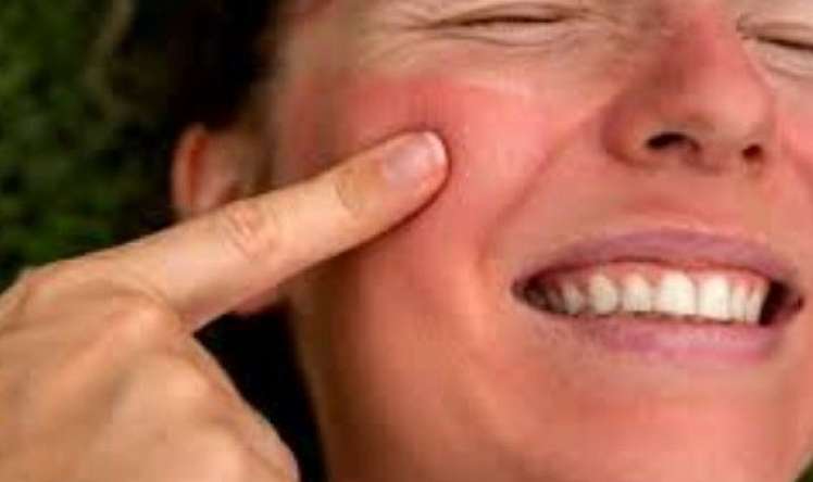 Üzünüzün bu hissəsi daim isti olursa... –  Alimlərdən yeni kəşf