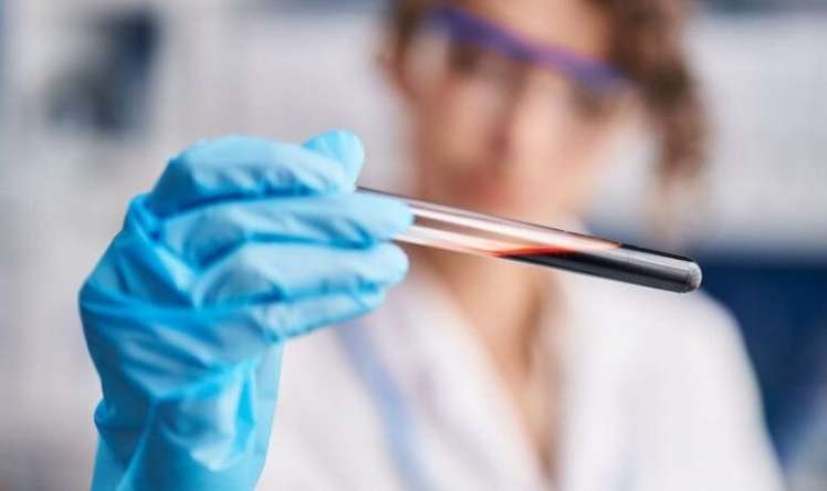 Qanda maqneziumun optimal səviyyədə olması  demensiya riskini azaldır