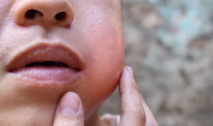 Rusiyada sonsuzluğa səbəb olan     təhlükəli epidemiya
