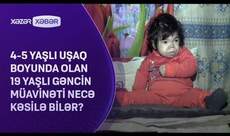 Bu uşağın 19 yaşı var  - Nadir diaqnoz