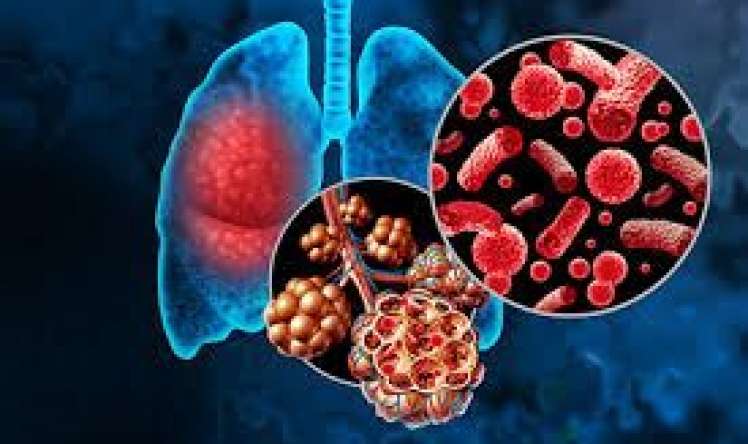 Qanlı öskürəyə səbəb olan təzə virus    açıqlandı