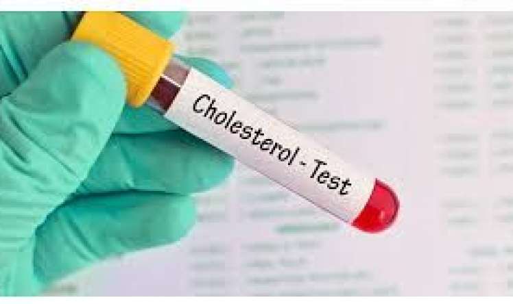 Xolesterin analizi nə vaxt verilməlidir? 