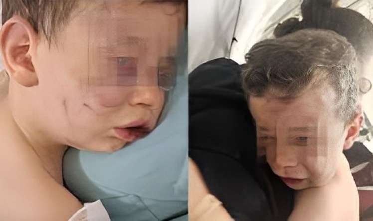 2 yaşlı uşaq vəhşicəsinə döyüldü -  FOTO