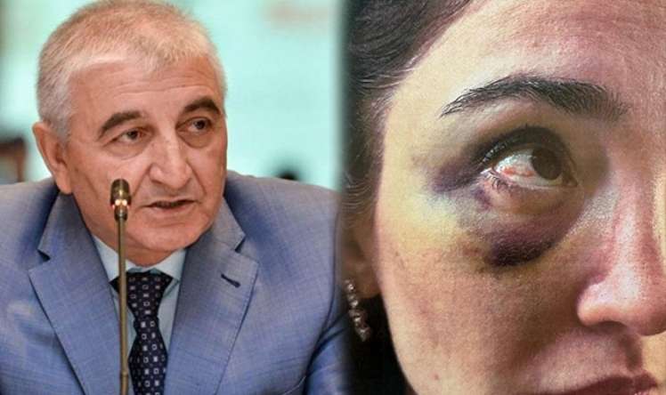 Məzahir Pənahovun oğlu arvadına işgəncə verdi -  FOTO