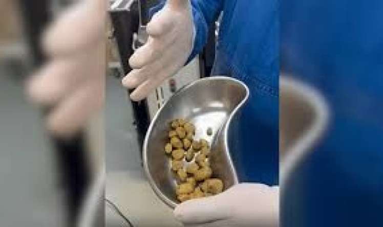 Kola içməkdən böyrəkləri daş bağladı  – Kuryoz olay