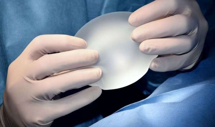 Mammoplastika  əməliyyatından sonra  – nadir xərçəngə tutuldu