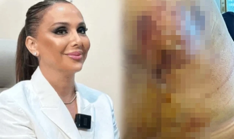 Həkim məni 3 dəfə əməliyyat edib pis vəziyyətə qoydu -  Daha bir məşhur cərrahdan ŞİKAYƏT