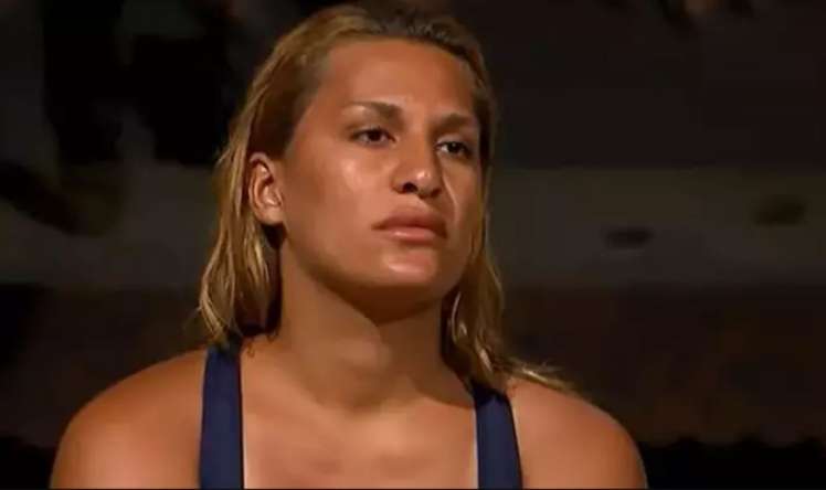 "Survivor"dan sonra plastik əməliyyat etdidi 