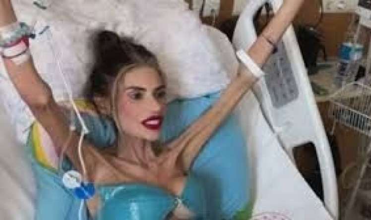  25 kiloya düşən Nihal Candan ölə bilər 