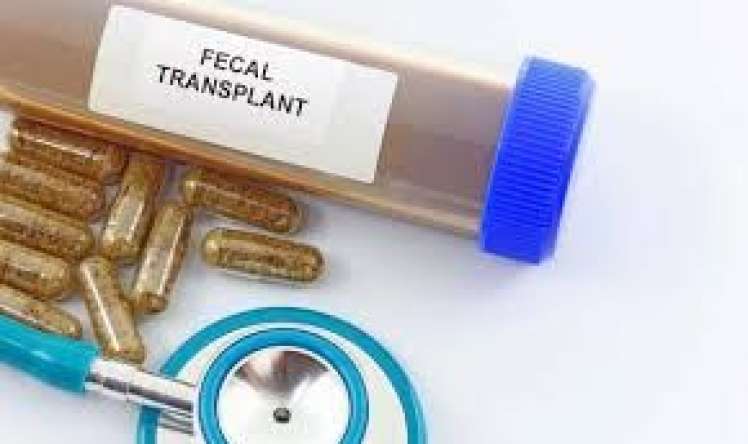 Nəcis transplantasiyası autizmi    müalicə edə bilər