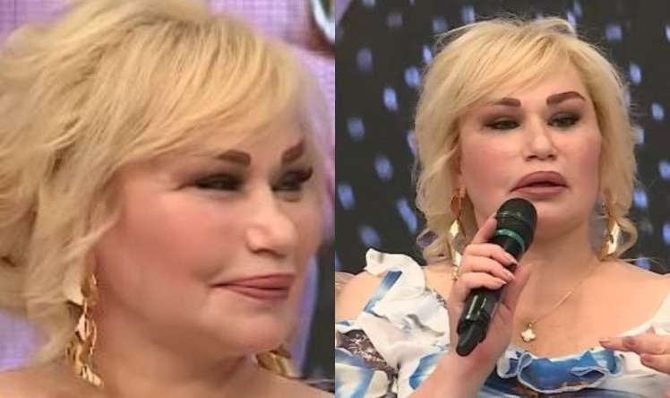 Daha bir müğənninin əməliyyatdan sonra    üzü əyildi