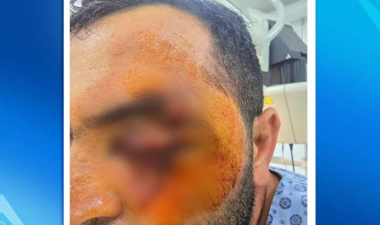 Elektrik mişarla üzü-gözü doğranan kişi    əməliyyat olundu