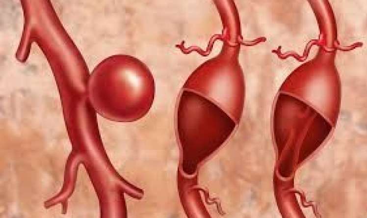 Hansı vitaminin əskikliyi damarları nazildir? 